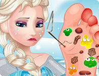 Jeu Mal de pied pour Elsa reine des neiges