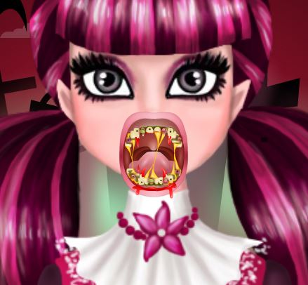 Jeu Draculaura la vampire au  dentiste